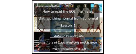 How to read the ECG in athletes: distinguishing normal from abnormal