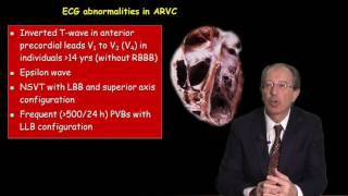 Lecture 2 - ECG Patterns in the Athletes