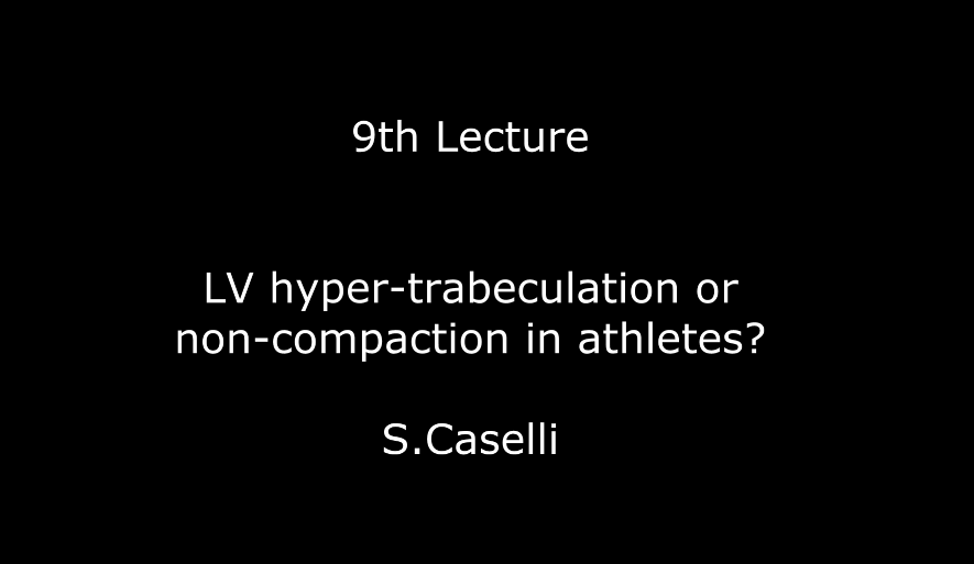 LV hyper-trabeculation or non-compaction in athletes? S.Caselli