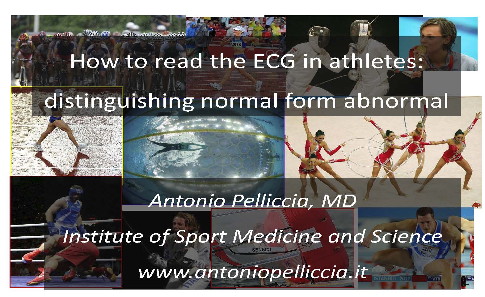 How to read the ECG in athletes